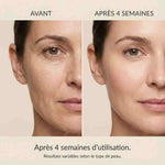 Sérum equallyberry au Bakuchiol - LATIFSérum equallyberry au BakuchiolSérum visageLATIFLATIFAchat uniqueSérum equallyberry au Bakuchiol